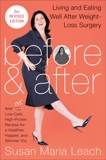 Before & After, Second Revised Edition: Living and Eating Well After Weight-Loss Surgery, Leach, Susan Maria