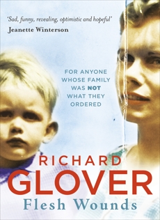 Flesh Wounds, Glover, Richard