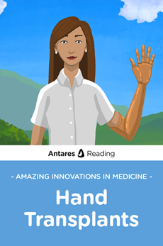 Amazing Innovations in Medicine: Hand Transplants, Antares Reading