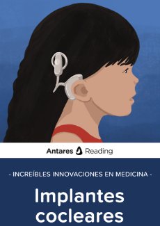 Increíbles innovaciones en medicina: implantes cocleares, Antares Reading